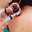 Podstawową metodą wykrywania czerniaka jest dermatoskopia