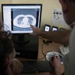 Testy mogą nie wykryć koronawirusa "ukrywającego się" w płucach