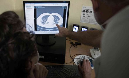 Testy mogą nie wykryć koronawirusa "ukrywającego się" w płucach