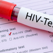 Wciąż za rzadko decydujemy się na badanie w kierunku HIV