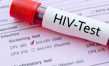 Wciąż za rzadko decydujemy się na badanie w kierunku HIV