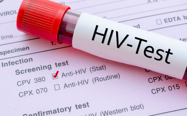 Wciąż za rzadko decydujemy się na badanie w kierunku HIV
