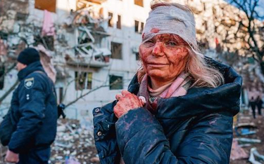 Ranna kobieta po ataku lotniczym sił rosyjskich na kompleks mieszkaniowy w mieście Czuhujew w obwodz