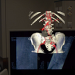 Na podstawie danych z tomografu tworzony jest trójwymiarowy hologram organu