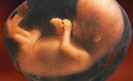 Rośnie liczba aborcji. Więcej wykrywanych wad płodów