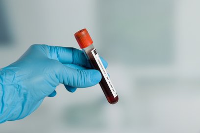 Badanie PSA zajmie około 10 minut - obejmuje wypełnienie dokumentów oraz pobranie próbki krwi