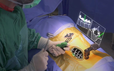 Augmendics wdrożył technologię przyszłości – ta wesprze chirurgów podczas skomplikowanych operacji