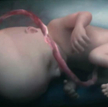 Rosja: mężczyźni zapłacą za aborcję