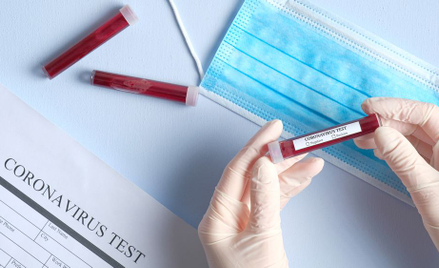 Koronawirus: czy wystarczy testów na COVID-19 w Polsce?
