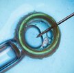 In vitro tylko dla par