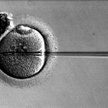 Zapłodnienie in vitro