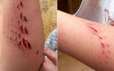 Gran Canaria: Rekin zaatakował turystkę