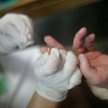 Będzie test na alzheimera
