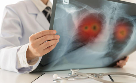 NIK o badaniach PET-CT: polscy lekarze diagnozują nowotwory dobrze, choć bezprawnie