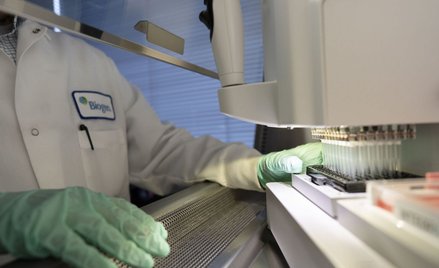 Nowy lek na Alzheimera: Rezygnacje po decyzji FDA