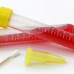 RPD: wprowadzić obowiązkowe testy DNA w sprawach o ustalenie ojcostwa