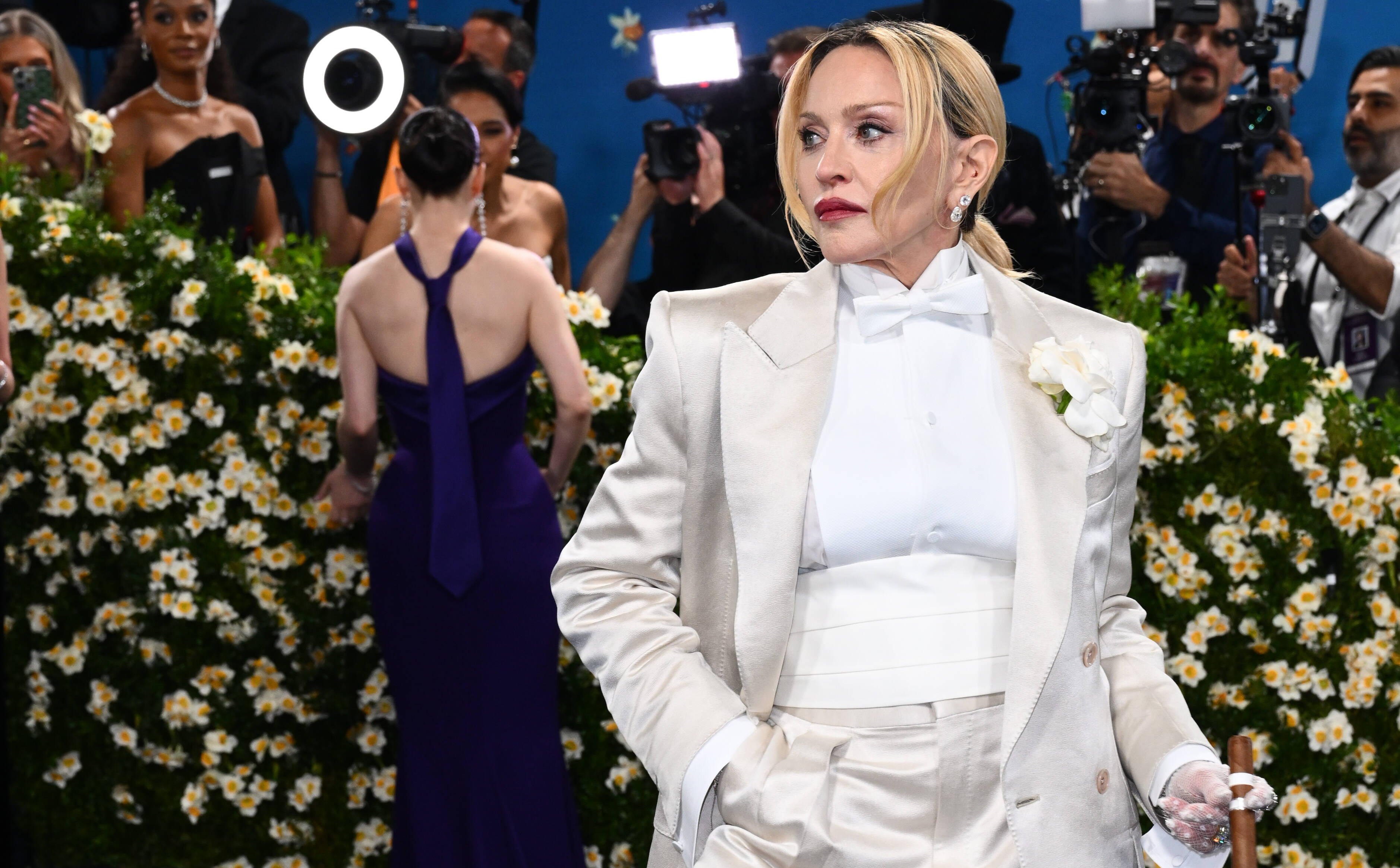 Obrońcy praw zwierząt zarzucają Madonnie, iż promuje okrucieństwo. W czym tkwi problem?