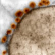 Wirusy Zika (pomarańczowe) atakują komórki układu nerwowego / Rodrigo Madeiro, IDOR