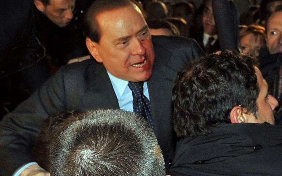 Silvio Berlusconi po ataku